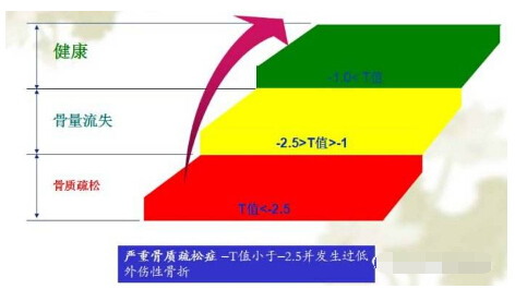 91看片在线下载安装经常看到91免费看片报告单中的Z 值和T 值有什么含义？