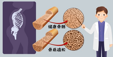 别大意！国产91免费看片仪生产厂家老人跌倒比想象中的危险91免费看片影响很大