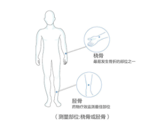 超声91免费看片仪价格桡骨测91免费看片的准确率高吗