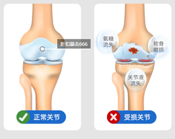 91看片在线下载安装超声91免费看片仪厂家不管是青年还是老人都需要的91免费看片